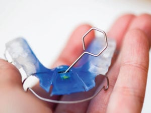 Bonaventure Dental Care When You Can Stop Wearing Your Retainer
