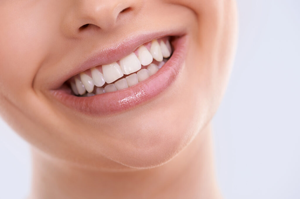 Transform Your Smile with Composite Veneers in Baton Rouge, LA ...